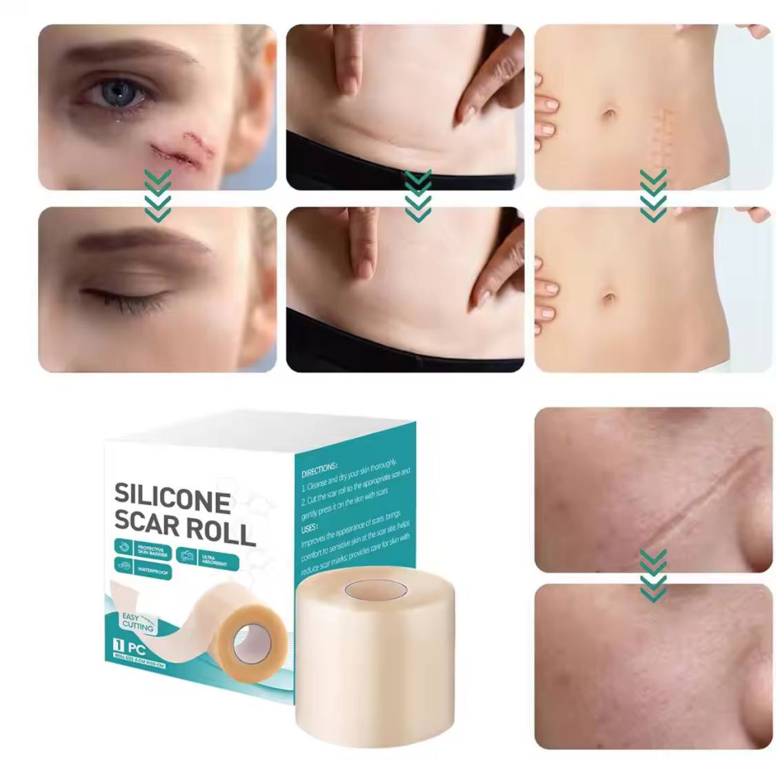 Silicone Scar Roll - Healing Hydrocolloid Technology