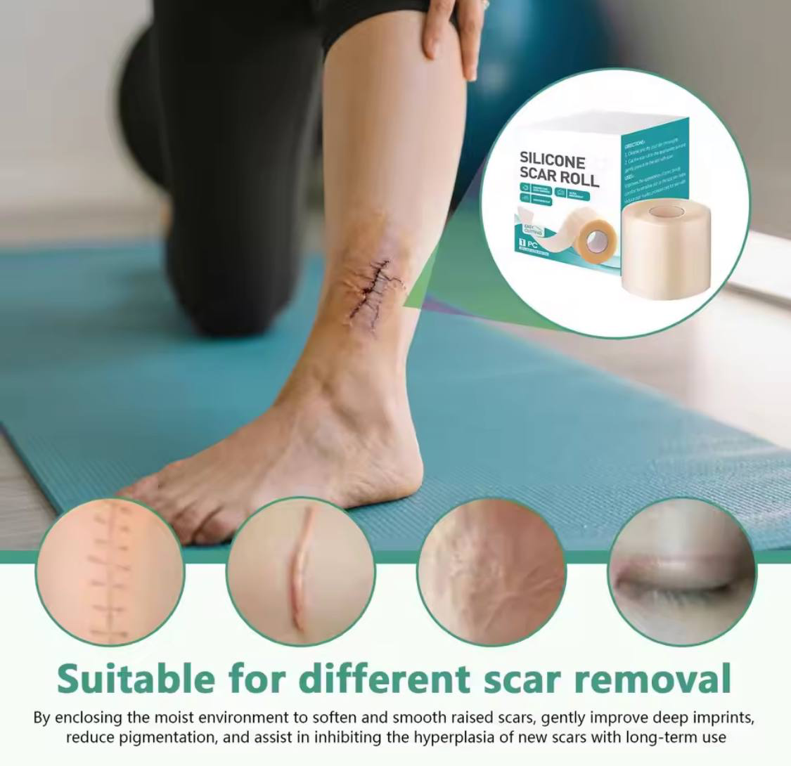 Silicone Scar Roll - Healing Hydrocolloid Technology