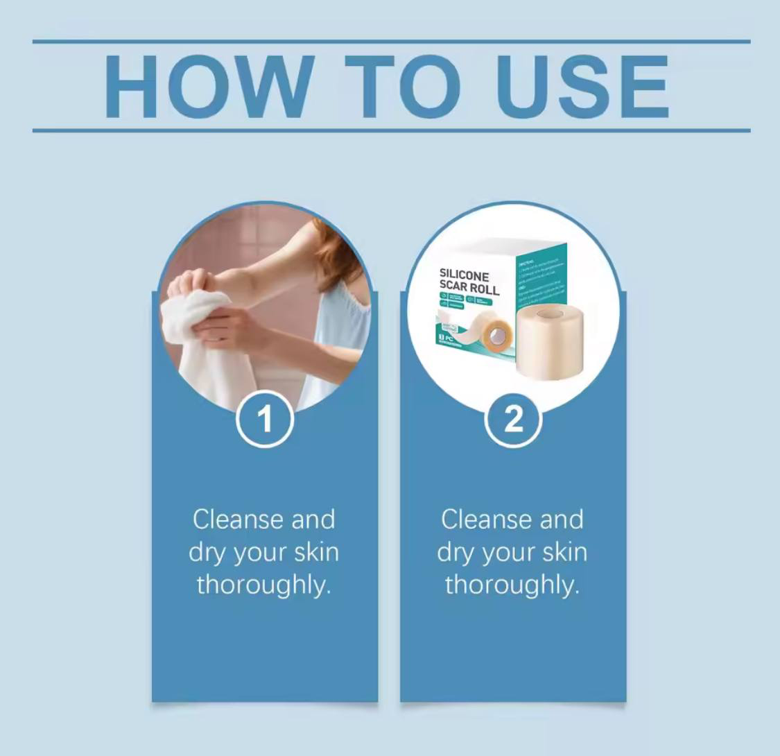 Silicone Scar Roll - Healing Hydrocolloid Technology